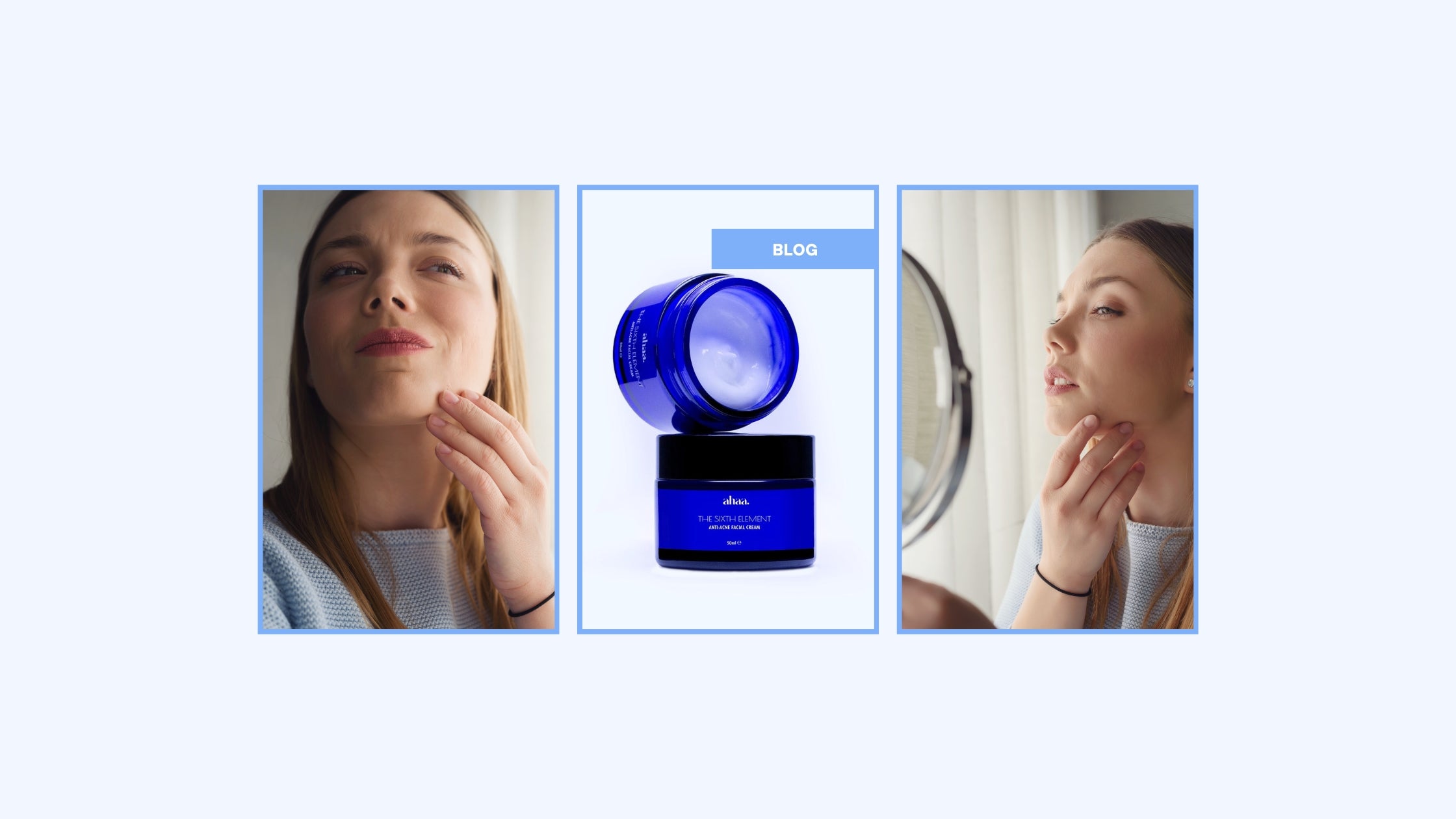 What are 5 Causes of Acne?