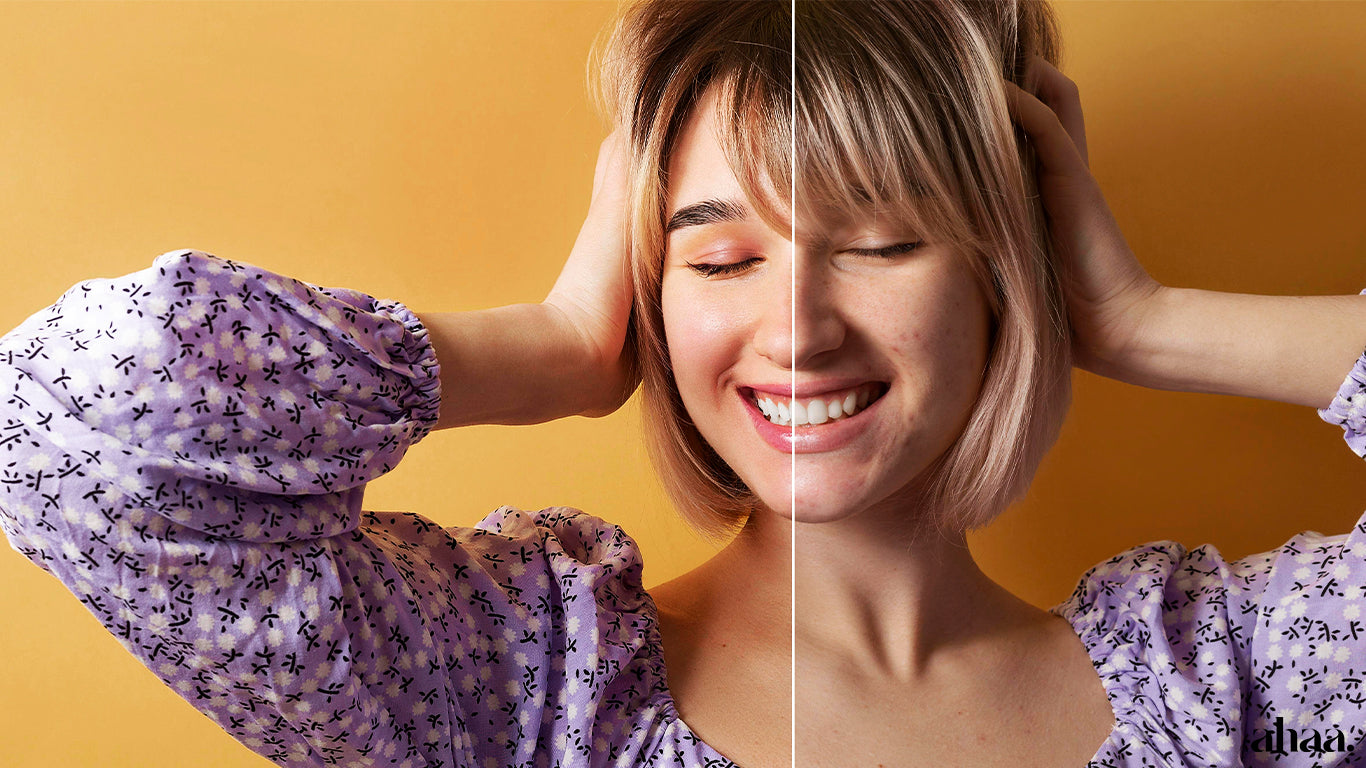 How to Get Rid of Acne in 3 Simple Steps